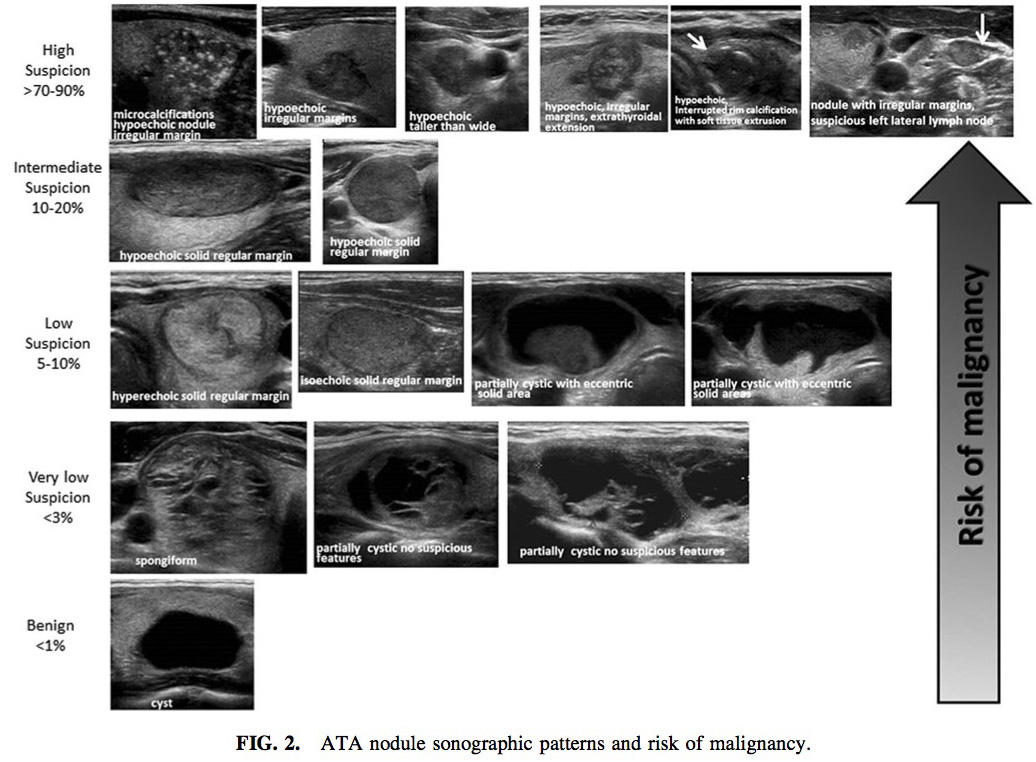 thyroid US patterns